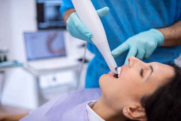 Dental Fillings at Belmont Dental Group Hamilton NJ