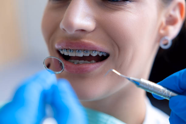 Orthodontics at Belmont Dental Group Hamilton NJ