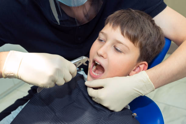 Tooth extractions at Belmont Dental Hamilton Township
