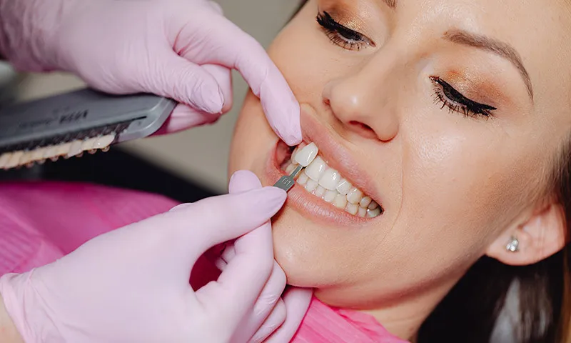 Teeth Whitening and Veneers at Belmont Dental Group Hamilton NJ