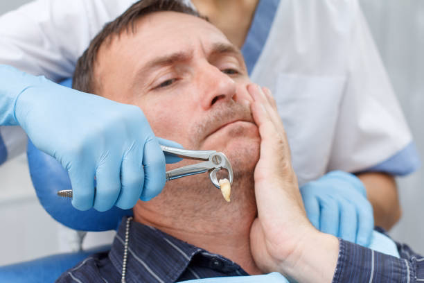 Wisdom Tooth Extractions at Belmont Dental Group Hamilton NJ